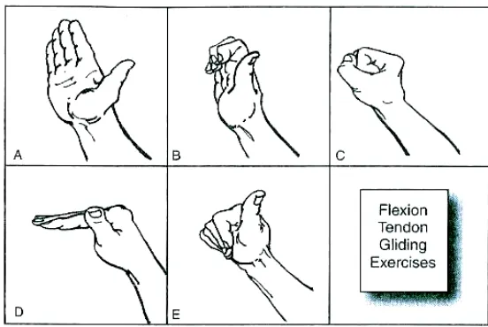 手腕彎曲運動動作順序示意圖