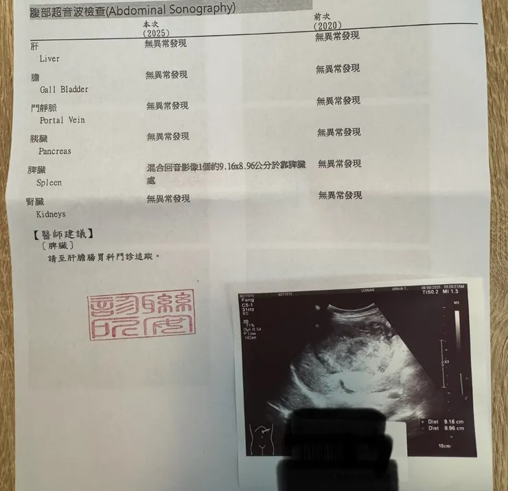 腹部超音波報告