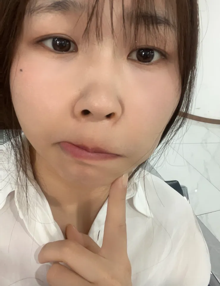 植牙後有小小腫