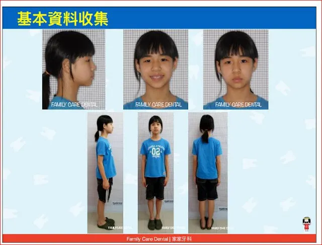 口外照，這比較輕鬆