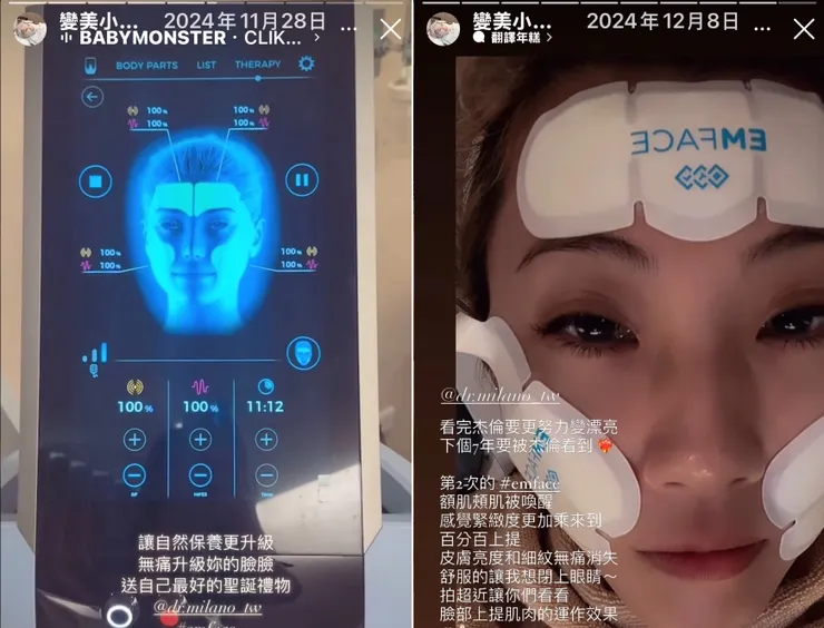 臉部深層肌肉激活效果與術後一個月揭密