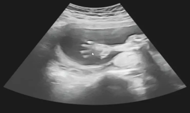 20w+4d活潑的寶寶可以看到手