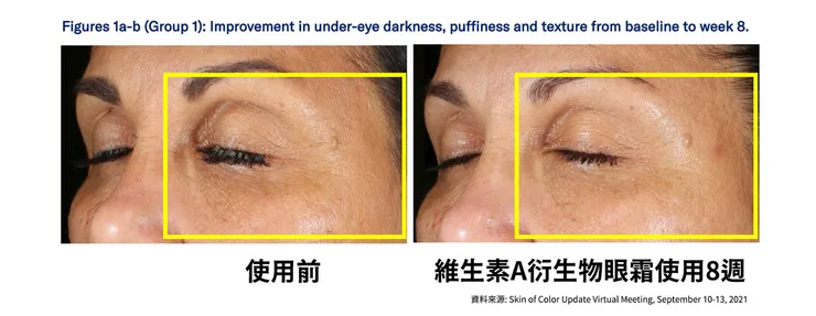 眼周保養成分怎麼選？