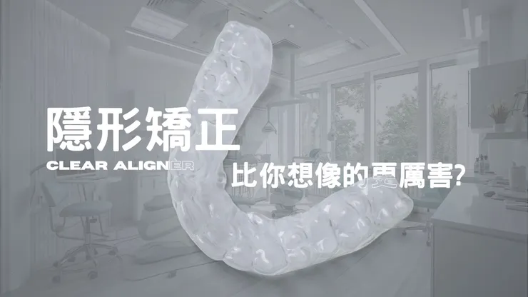 什麼是隱形矯正？透明牙套一次看懂！