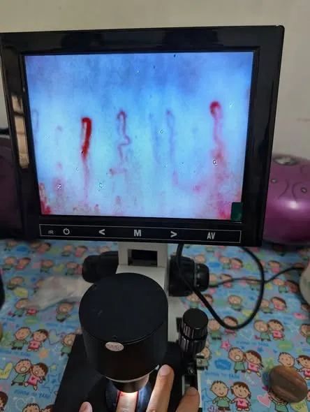 血管正常藥又直又細才對