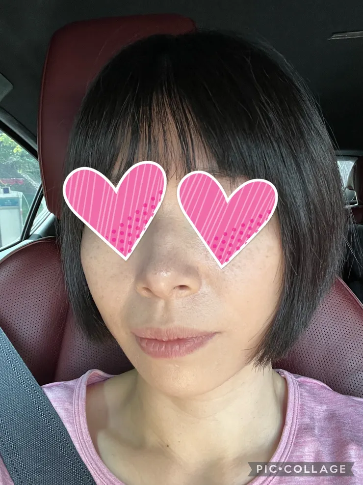 近看還是毛毛，但比前兩天好很多了，至少沒裂掉。