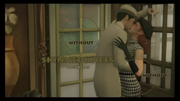 skinnedknees by moonsyrups