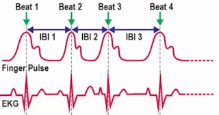每次心跳間的間距(IBI)，第二次心跳間的間距(IBI2)明顯比第一次心跳間的間距(IBI1)短。圖片取自SA8023 360 Suite Reference Manual