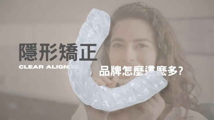 隱形矯正這麼多？我該如何選擇？透明牙套挑選指南一次看懂！