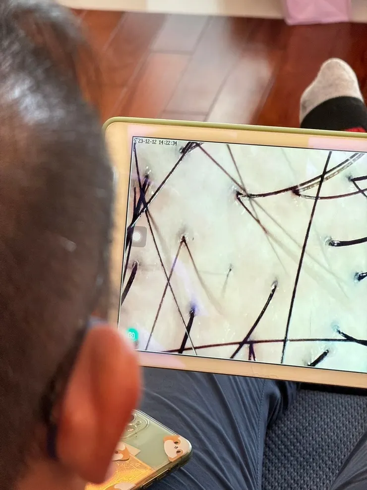 台南美容課程【柔星國際美容教育】毛母開通外泌體御髮教學│養髮