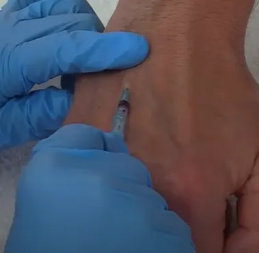 非慣用手輕壓靜脈