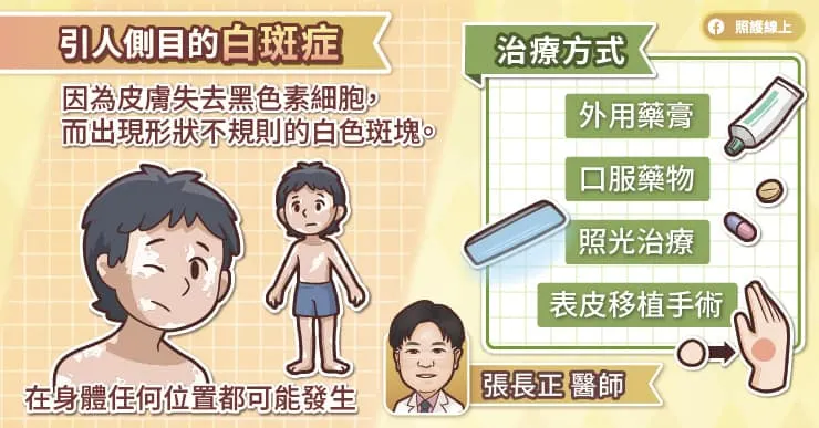 白斑症患者的皮膚會失去黑色素細胞,而出現形狀不規則的白色斑塊。