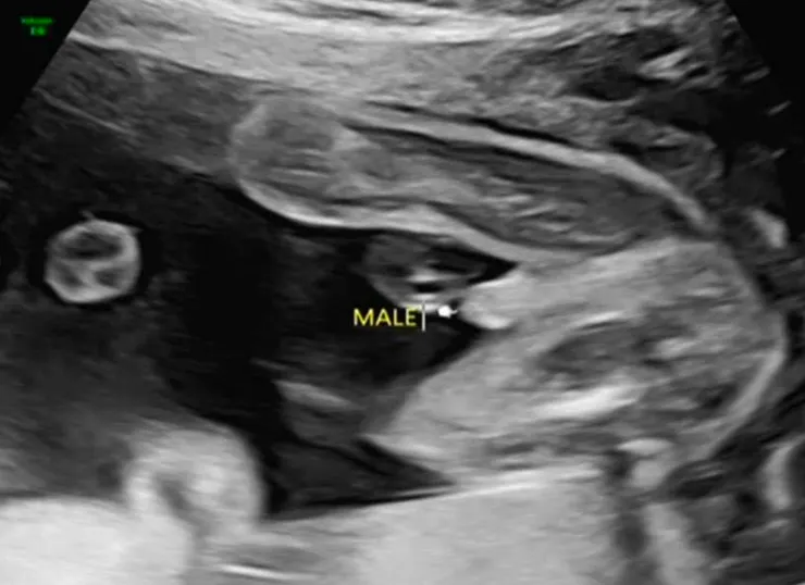 老公：醫生說是男生之後的事我都沒在聽