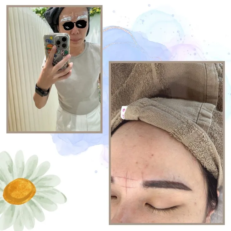 左上：霧眉前會敷上白白的麻藥／右下：當天霧眉後的狀況