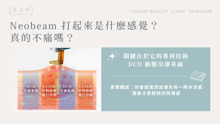 【術後全攻略】Neobeam 清新光會痛嗎？有沒有修復期？一篇文章幫你解惑