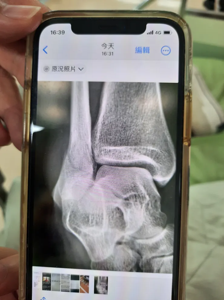 現在都用手機翻拍解釋，很快速！