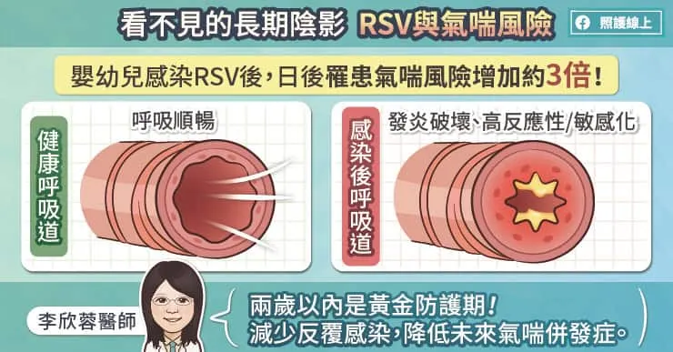 RSV未來罹患氣喘的風險