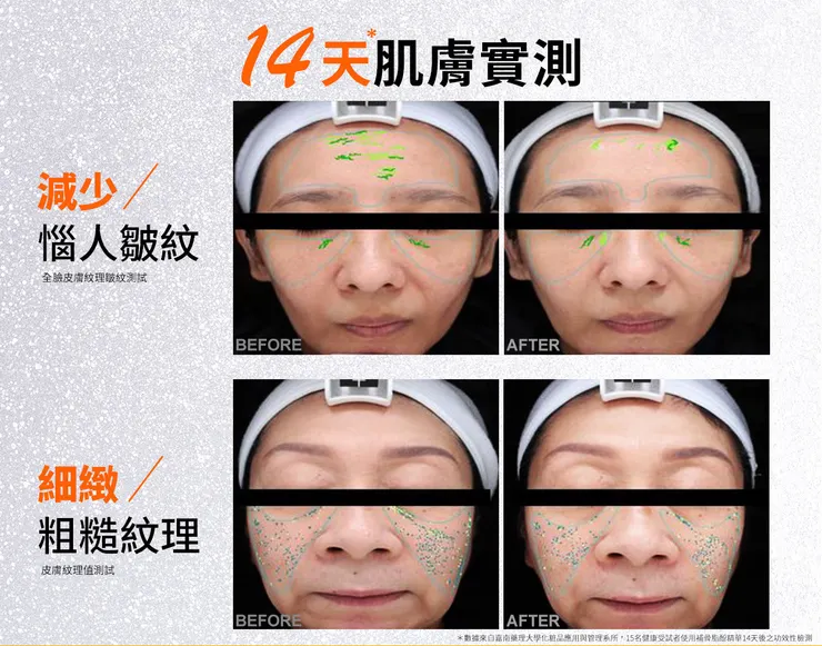 補骨脂酚保養功效有哪些？深入挑戰「補骨脂酚」的保養計畫