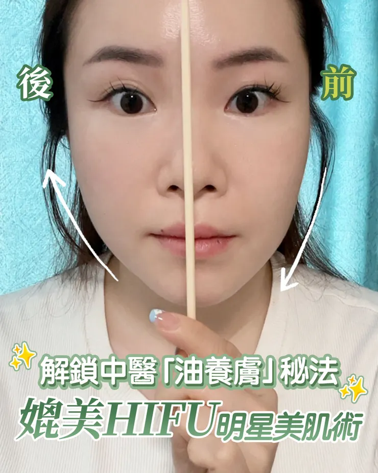 中醫打造V面神技！ 明星級「油養膚」美肌秘訣公開！