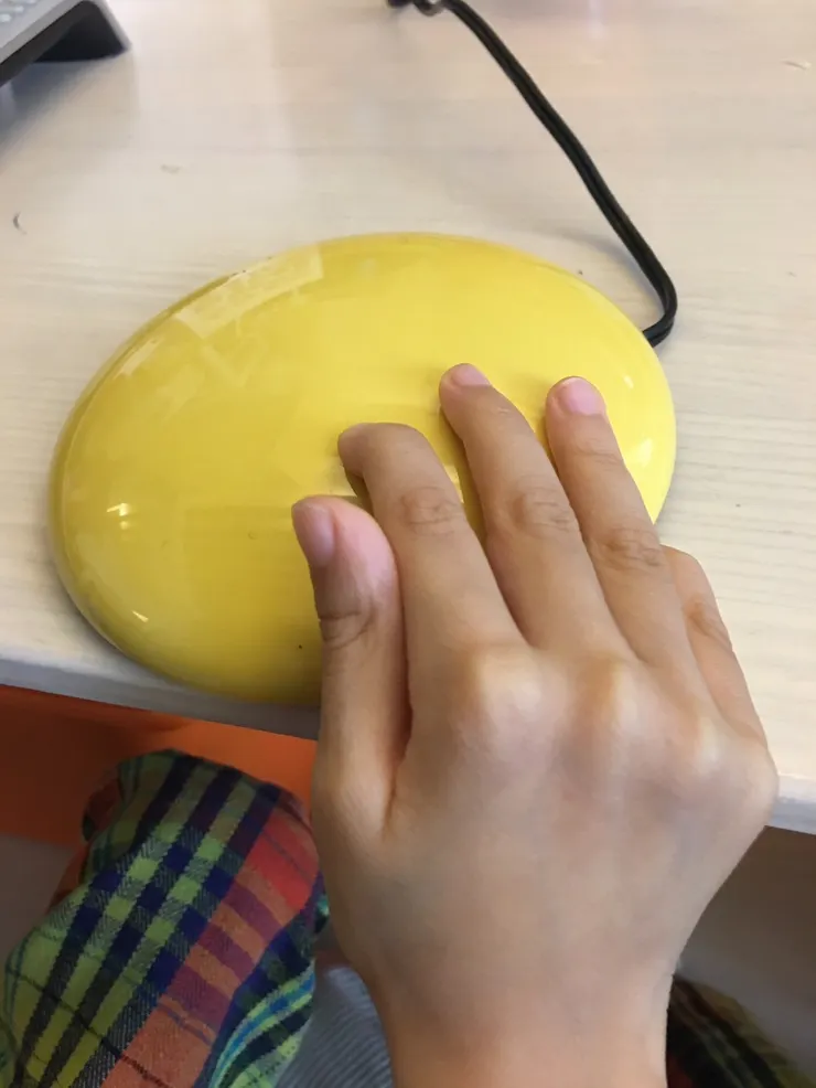 腦傷的孩子要能透過手指頭敲溝通板表達也是非常有難度的。