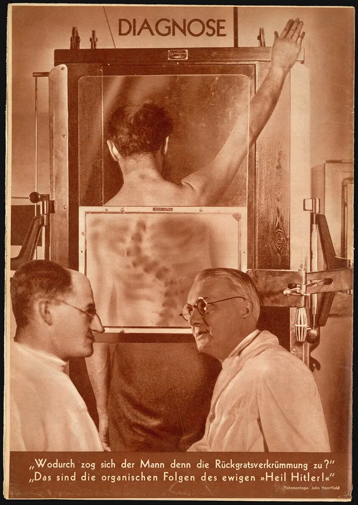 John Heartfield，《Untitled （Diagnosis）》，1935。｜圖片來源：The Art Institute of Chicago