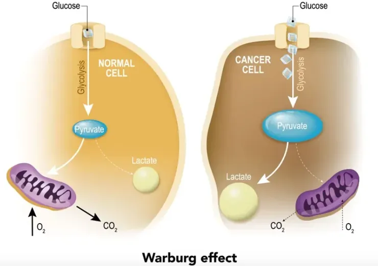 正常細胞吸收糖分後大部分進入有氧呼吸,癌細胞則大部分進入糖解作用產生乳酸
