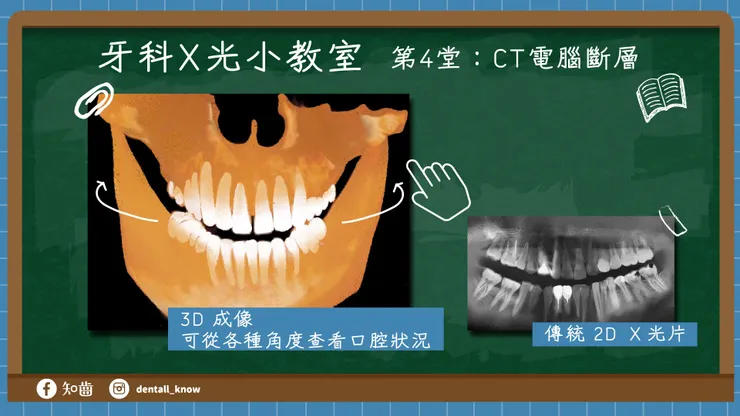 牙科 X 光小教室 第4堂：CT 電腦斷層