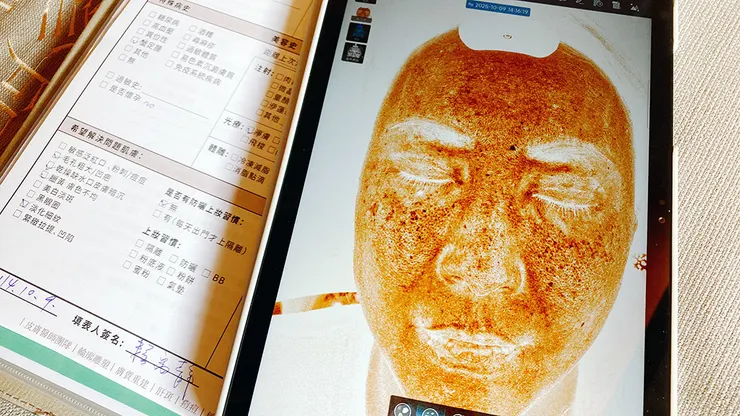 台北東區打雷射｜RedTouch PRO凍態雷射(果凍光)│台北打雷射推薦綻妍醫美診所