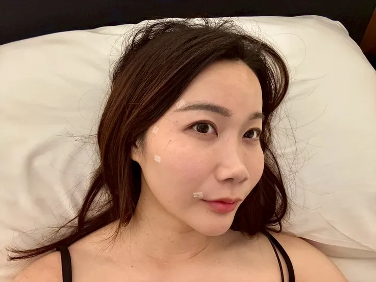 泰國曼谷醫美體驗|曼谷音波拉提推薦?泰國醫美諮詢流程與中文服務心得Best Friend Clinic