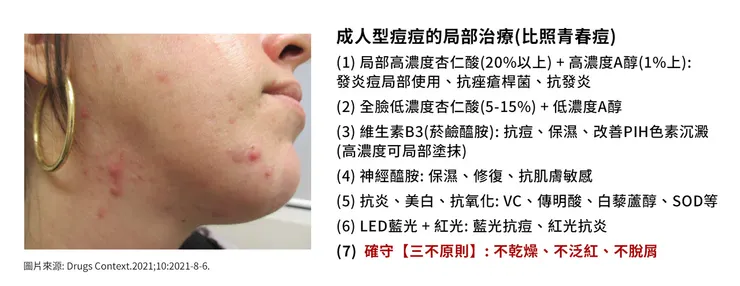 悶痘長不停怎麼辦?