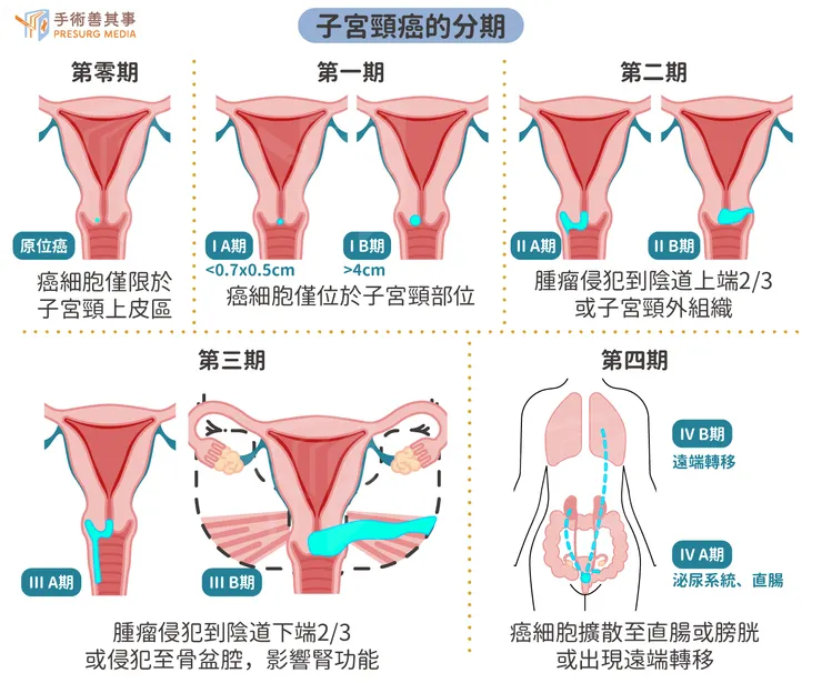 圖片來源:手術善其事