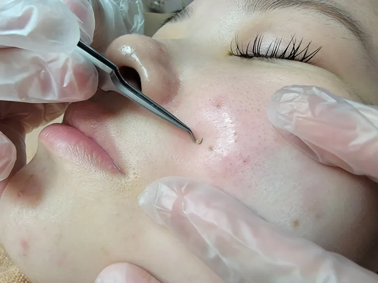 台南做臉推薦~聖誕跨年美美玩!水水臉蛋兒交給FILF小資美顏