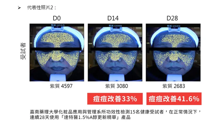 「A醇」現代抗老神器！