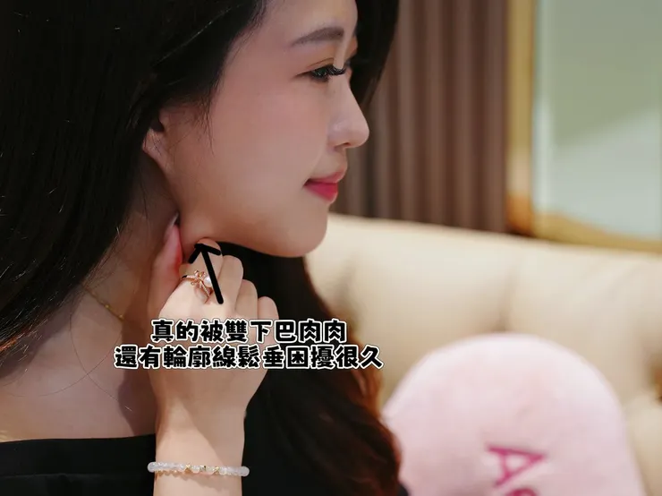 台北Z音波拉提推薦【板橋聖宜診所】終於找回緊緻V感,告別老