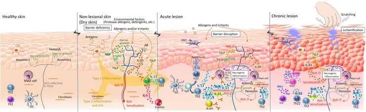 引用自→Peripheral itch sensitization in atopic dermatitis報告Fig. 8.